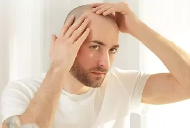 How Long Does The Hair Transplant Process Take?