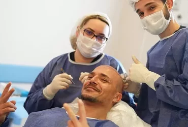 When Is The Best Time To Get A Hair Transplant?